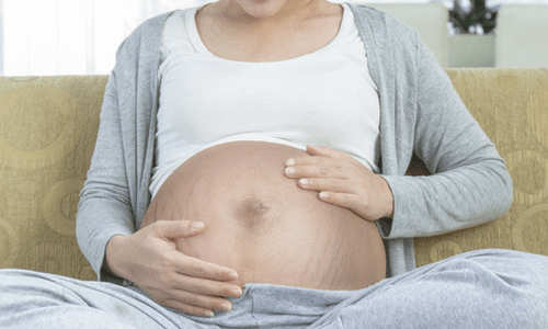 Pregnancy Skin Changes stretch marks